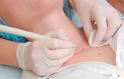 Die Ursachen des menschlichen Papillomvirus