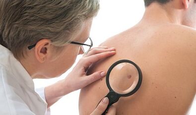 Menschliches Papillomvirus bei Männern