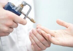 moderne Methoden zur Entfernung von Papillomen